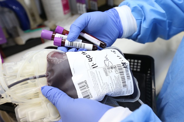 Risk för hjärnblödning överförs via blodtransfusion: Borde vi vara oroliga?